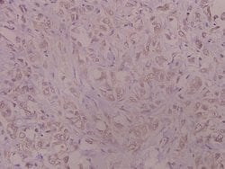 Invitrogen Catalase Polyclonal Antibody 100 &mu;L; Unconjugated:Antibodies,