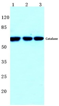 Invitrogen Catalase Polyclonal Antibody 100 &mu;L; Unconjugated:Antibodies,