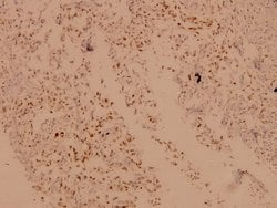 Invitrogen CRYAB Polyclonal Antibody 100 &mu;L; Unconjugated:Antibodies,
