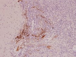 Invitrogen IL9R Polyclonal Antibody 100 &mu;L; Unconjugated:Antibodies,