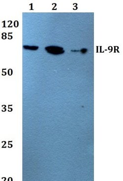 Invitrogen IL9R Polyclonal Antibody 100 &mu;L; Unconjugated:Antibodies,