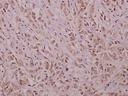 Invitrogen YAP1 Polyclonal Antibody 100 &mu;L | Buy Online | Invitrogen&trade; | Fisher Scientific