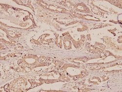 Invitrogen ERAB Polyclonal Antibody 100 &mu;L; Unconjugated:Antibodies,