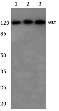 Invitrogen ATP Citrate Lyase Polyclonal Antibody 100 &mu;L; Unconjugated:Antibodies,