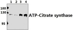 Invitrogen ATP Citrate Lyase Polyclonal Antibody 100 &mu;L; Unconjugated:Antibodies,