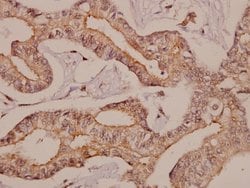 Invitrogen beta-2 Adrenergic Receptor Polyclonal Antibody 100 &mu;L; Unconjugated:Antibodies,