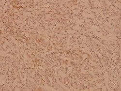 Invitrogen hnRNP C Polyclonal Antibody 100 &mu;L; Unconjugated:Antibodies,