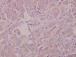 Invitrogen IFNAR1 Polyclonal Antibody 100 &mu;L; Unconjugated:Antibodies,