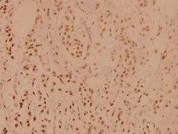 Invitrogen PP1 alpha Polyclonal Antibody 100 &mu;L; Unconjugated:Antibodies,