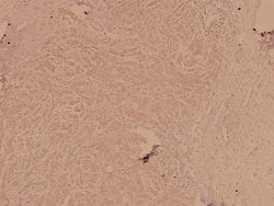 Invitrogen FGFR1 Polyclonal Antibody 100 &mu;L; Unconjugated:Antibodies,