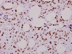 Invitrogen RSK1 Polyclonal Antibody 100 &mu;L; Unconjugated:Antibodies,