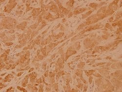 Invitrogen RhoA Polyclonal Antibody 100 &mu;L; Unconjugated:Antibodies,