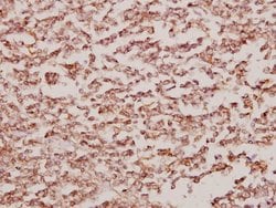 Invitrogen BCKDK Polyclonal Antibody 100 &mu;L; Unconjugated:Antibodies,