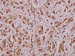 Invitrogen APRIL Polyclonal Antibody 100 &mu;L; Unconjugated:Antibodies,