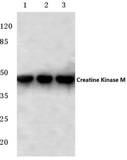 Invitrogen Creatine Kinase MM Polyclonal Antibody 100 &mu;L; Unconjugated:Antibodies,