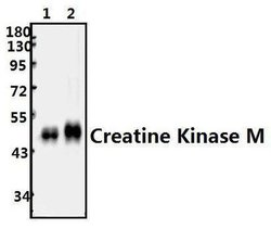 Invitrogen Creatine Kinase MM Polyclonal Antibody 100 &mu;L; Unconjugated:Antibodies,