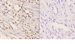 Invitrogen HMGB1 Polyclonal Antibody 100 &mu;L; Unconjugated:Antikroppar