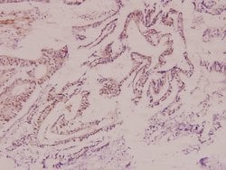 Invitrogen HK1 Polyclonal Antibody 100 &mu;L; Unconjugated:Antibodies,