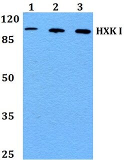 Invitrogen HK1 Polyclonal Antibody 100 &mu;L; Unconjugated:Antibodies,