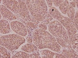 Invitrogen EphA1 Polyclonal Antibody 100 &mu;L; Unconjugated:Antibodies,