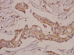 Invitrogen GRK2 Polyclonal Antibody 100 &mu;L; Unconjugated:Antibodies,