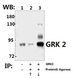 Invitrogen GRK2 Polyclonal Antibody 100 &mu;L; Unconjugated:Antibodies,