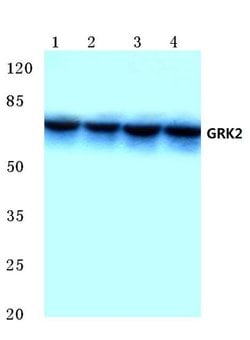 Invitrogen GRK2 Polyclonal Antibody 100 &mu;L; Unconjugated:Antibodies,