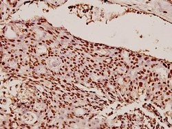 HP1 alpha Polyclonal Antibody:Antibodies, Polyclonal