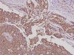 Invitrogen YAP1 Polyclonal Antibody 100 &mu;L; Unconjugated:Antibodies,