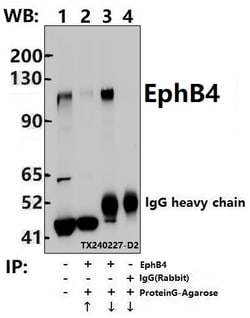 Invitrogen EphB4 Polyclonal Antibody 100 &mu;L; Unconjugated:Antibodies,