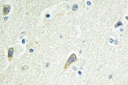 Invitrogen EphB4 Polyclonal Antibody 100 &mu;L; Unconjugated:Antibodies,