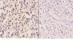 Invitrogen ELL Polyclonal Antibody 100 &mu;L; Unconjugated:Antibodies,
