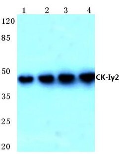 Invitrogen CK1 gamma-2 Polyclonal Antibody 100 &mu;L; Unconjugated:Antistoffer