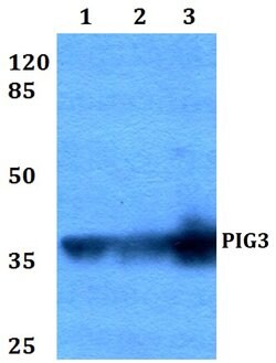 Invitrogen PIG3 Polyclonal Antibody 100 &mu;L; Unconjugated:Antibodies,