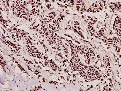 PYCARD Polyclonal Antibody:Antibodies, Polyclonal