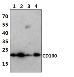Invitrogen CD160 Polyclonal Antibody 100 &mu;L; Unconjugated:Antibodies,