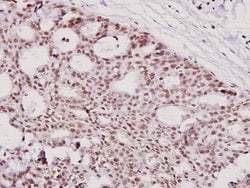 Invitrogen ICAD Polyclonal Antibody 100 &mu;L | Buy Online | Invitrogen&trade; | Fisher Scientific