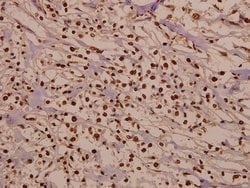 Invitrogen CDK2 Polyclonal Antibody 100 &mu;L; Unconjugated:Antibodies,