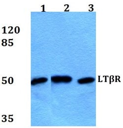 Invitrogen LTBR Polyclonal Antibody 100 &mu;L; Unconjugated:Antibodies,