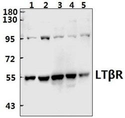 Invitrogen LTBR Polyclonal Antibody 100 &mu;L; Unconjugated:Antibodies,