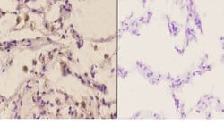 Invitrogen MAP2K4 Polyclonal Antibody 100 &mu;L; Unconjugated:Antibodies,