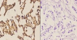 Invitrogen MAP2K4 Polyclonal Antibody 100 &mu;L; Unconjugated:Antibodies,