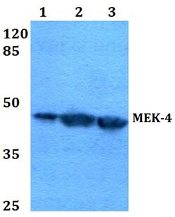 Invitrogen MAP2K4 Polyclonal Antibody 100 &mu;L; Unconjugated:Antibodies,