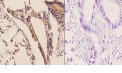 Invitrogen CDH17 Polyclonal Antibody 100 &mu;L; Unconjugated:Antibodies,
