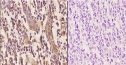 Invitrogen Apolipoprotein J Polyclonal Antibody 100 &mu;L; Unconjugated:Antibodies,