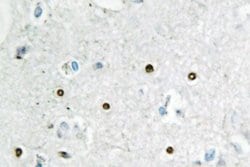 Invitrogen MSH6 Polyclonal Antibody 100 &mu;L; Unconjugated:Antibodies,