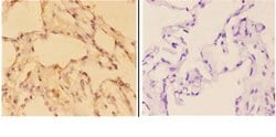 Invitrogen c-Abl Polyclonal Antibody 100 &mu;L; Unconjugated:Antibodies,