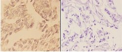 Invitrogen c-Abl Polyclonal Antibody 100 &mu;L; Unconjugated:Antibodies,