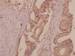 Invitrogen DNA Ligase I Polyclonal Antibody 100 &mu;L; Unconjugated:Antibodies,