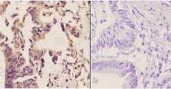 Invitrogen MGMT Polyclonal Antibody 100 &mu;L; Unconjugated:Antibodies,